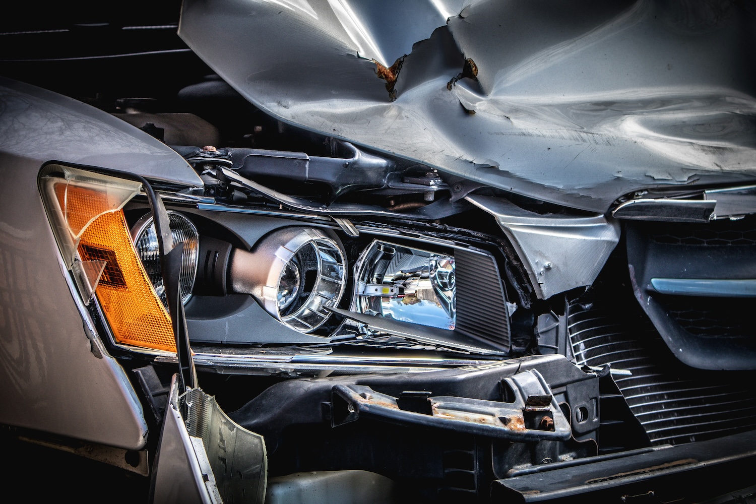 Injured in a Car Accident in Ontario? Your Next Steps Explained